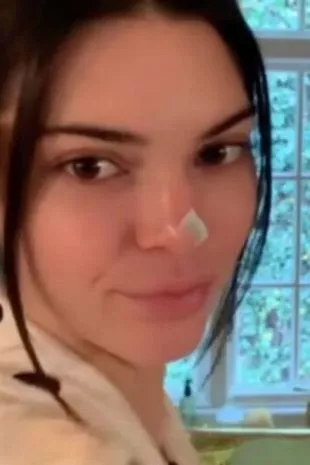 Kendall Jenner